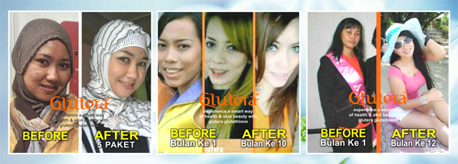  photo GLUTATHIONE_GLUTERA_MIDBANNER_20140714075659_zps92d31703.png