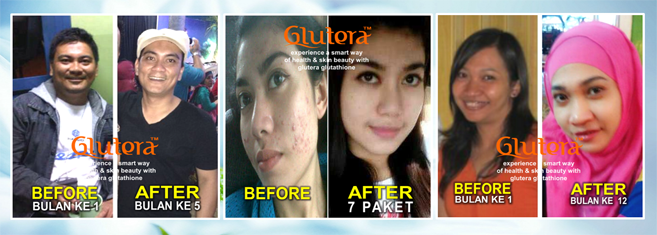  photo GLUTATHIONE_GLUTERA_MIDBANNER_20140806075707_zpsdb4a5ce9.png